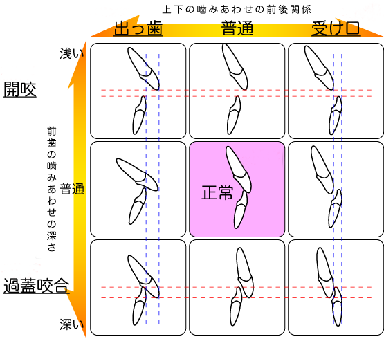 ご自身の口元を見てみてください