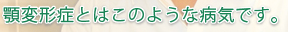 顎変形症とはこのような病気です。